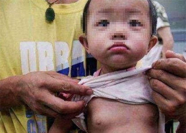 Giáo sư khoa Nhi cảnh báo: Trẻ dậy thì sớm để lại hậu quả nghiêm trọng-2