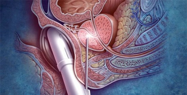 Chuyên gia cảnh báo nước tiểu vàng đục đang cảnh báo gì về sức khỏe của bạn?-4