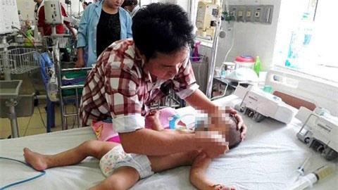 kinh hoang chau be gan 2 tuoi bi hang nghin vet ong dot - 1