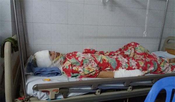 Người vợ bị chồng cũ tạt axit vì ghen tuông: Con tha thứ và không muốn anh ấy đi tù”-1