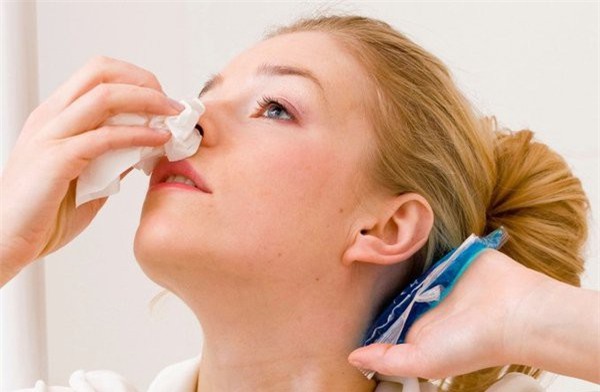 Để chảy máu cam chấm dứt không phải ngửa đầu ra sau, đây mới là cách sơ cứu đúng!-3