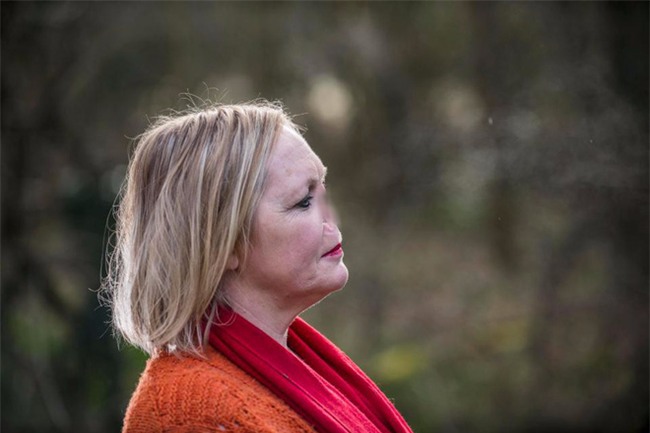 Bị chú chó làm tổn thương mũi, người phụ nữ phải cắt bỏ hẳn một phần gương mặt nhưng vẫn biết ơn thú cưng của mình - Ảnh 4.