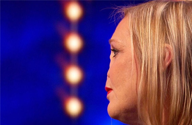 Bị chú chó làm tổn thương mũi, người phụ nữ phải cắt bỏ hẳn một phần gương mặt nhưng vẫn biết ơn thú cưng của mình - Ảnh 5.