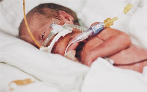 bung bau khong lo chua 5 em be, thai ky tang 33kg cua ba me 7 con - 6