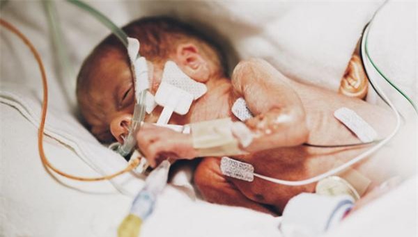 bung bau khong lo chua 5 em be, thai ky tang 33kg cua ba me 7 con - 8