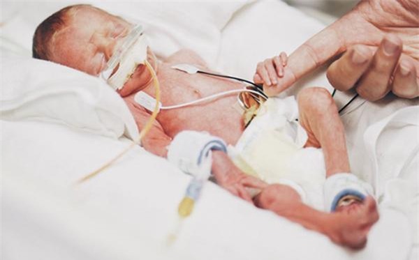 bung bau khong lo chua 5 em be, thai ky tang 33kg cua ba me 7 con - 9