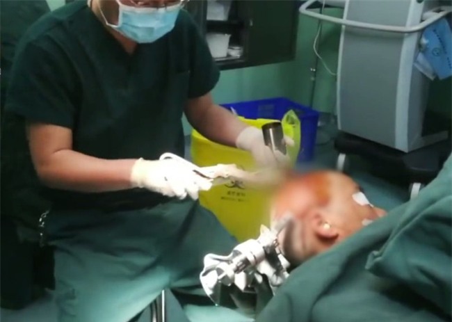 Người phụ nữ thoát chết trong gang tấc sau khi bị kéo rơi trúng đầu - Ảnh 2.