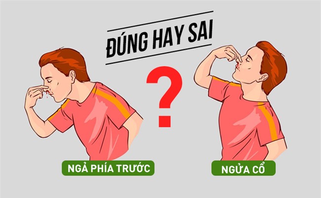Chuyên gia chỉ rõ nên ngả phía trước hay ngửa đầu ra sau khi chảy máu cam-1