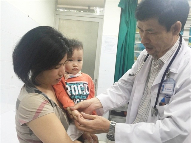 Ba dấu hiệu sớm cảnh báo diễn biến nặng của bệnh tay chân miệng ở trẻ-1