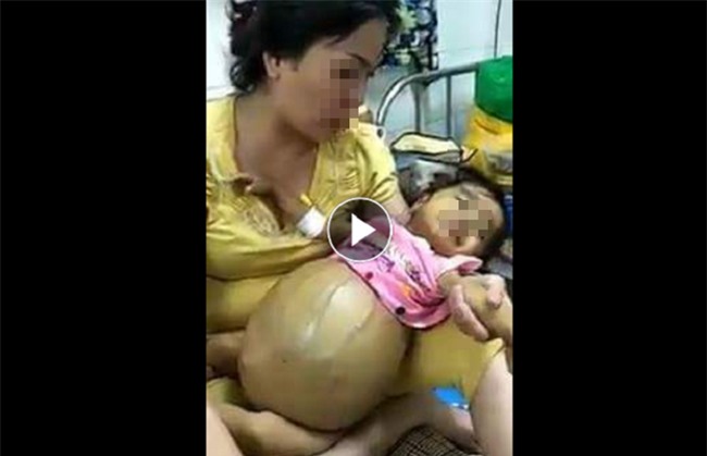 Cảnh báo: Bé gái ung thư tụy đã mất 3 tháng vẫn bị kẻ xấu nhẫn tâm đưa hình ảnh lên mạng trục lợi - Ảnh 1.