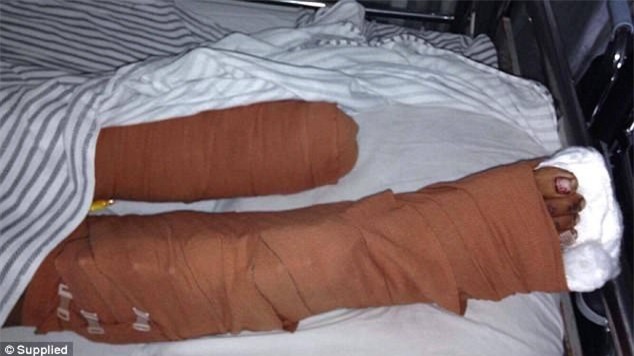 Tưởng tàn phế cả đời vì bị chồng say rượu chặt chân, người phụ nữ vượt lên nghịch cảnh nhờ lòng tốt của người lạ - Ảnh 3.