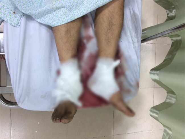 Lấy dấu vân tay để xác minh danh tính nạn nhân vụ kéo lê hàng trăm mét trên phố Hà Nội - Ảnh 1.