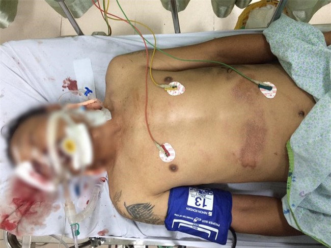 Lấy dấu vân tay để xác minh danh tính nạn nhân vụ kéo lê hàng trăm mét trên phố Hà Nội - Ảnh 1.