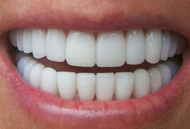 Bác sĩ BV Răng hàm mặt chỉ rõ 3 biến chứng đáng sợ của răng sứ thẩm mỹ-2