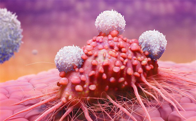 Hiệp hội Ung thư Hoa Kỳ khẳng định, có thể giảm ngay 50% nguy cơ ung thư bằng cách này-1