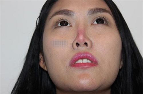 khuon mat cung do, nam lan bay luot bien dang khien my nhan viet vuong nghi van pttm - 8