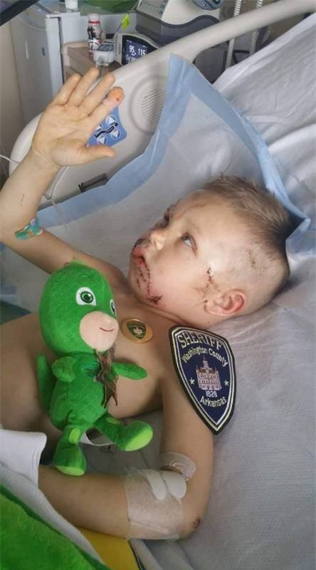 Bức ảnh mà các bậc phụ huynh nên lưu tâm chụp bé trai bị biến dạng khuôn mặt vì 2 con chó tấn công - Ảnh 3.