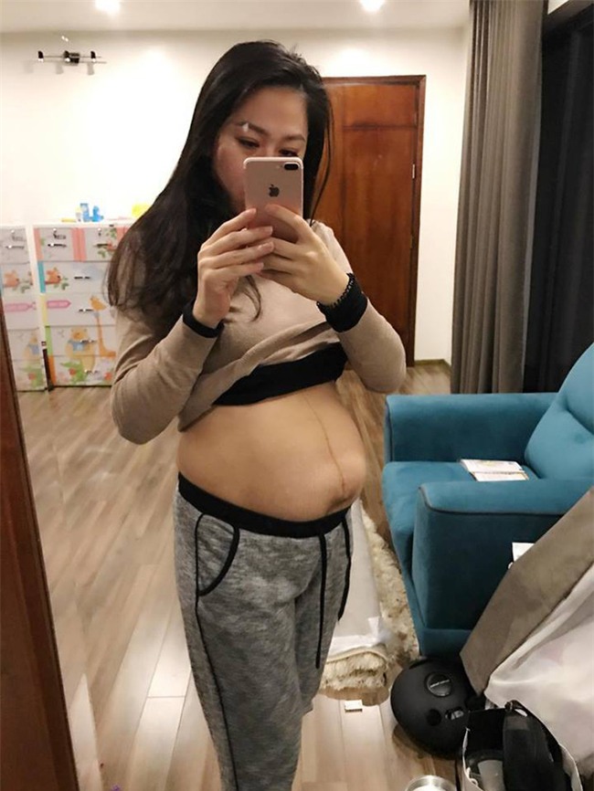 Vết rạn - tâm sự của người phụ nữ vừa sinh đôi gây xúc động mạnh - Ảnh 1.