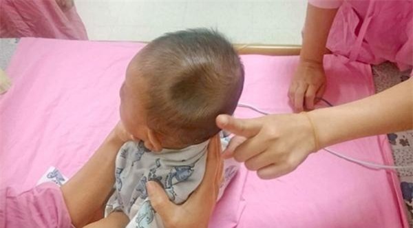 be 4 thang dau lom sau nhu qua tao can do do sai lam cua nguoi me - 1