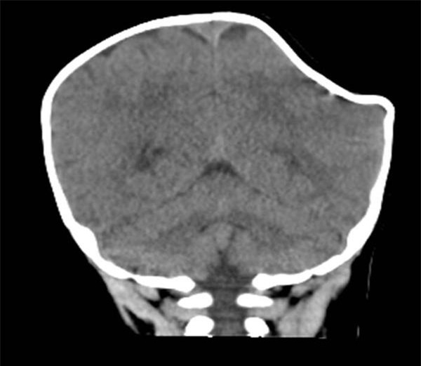 be 4 thang dau lom sau nhu qua tao can do do sai lam cua nguoi me - 2