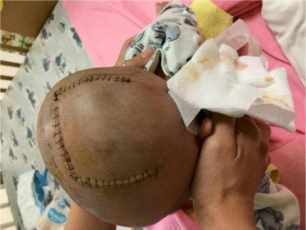 be 4 thang dau lom sau nhu qua tao can do do sai lam cua nguoi me - 3