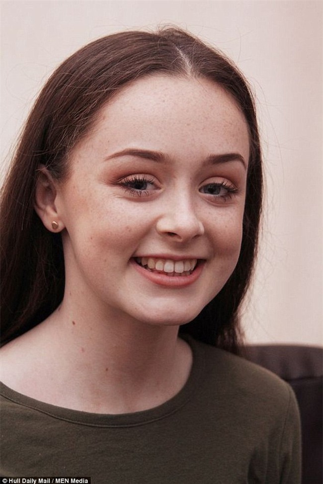 Cô gái 15 tuổi suýt chết vì bệnh nhiễm khuẩn, nguyên nhân được chẩn đoán là từ... niềng răng - Ảnh 1.