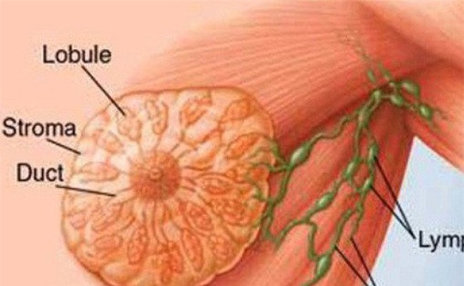 Bác sĩ BV K khuyến cáo: Phát hiện trên ngực có khối u này, chị em nên bình tĩnh xử trí-1