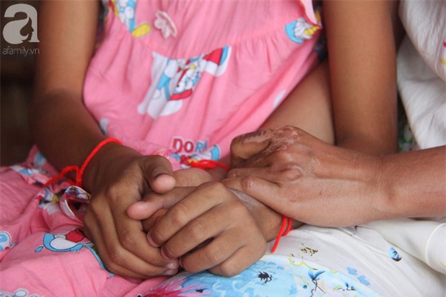 Con rể ghen với bố vợ, phóng hỏa đốt cả nhà khiến bố vợ tử vong, hai mẹ con bị phỏng không có tiền chạy chữa - Ảnh 8.