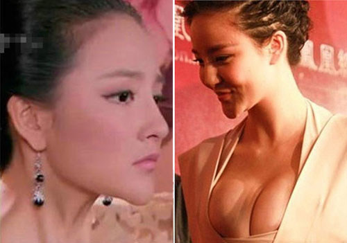 Nghiện phẫu thuật thẩm mỹ, Lưu Vũ Hân ngày càng xuống sắc. Đặc biệt là chiếc cằm của cô ngày càng biến dạng