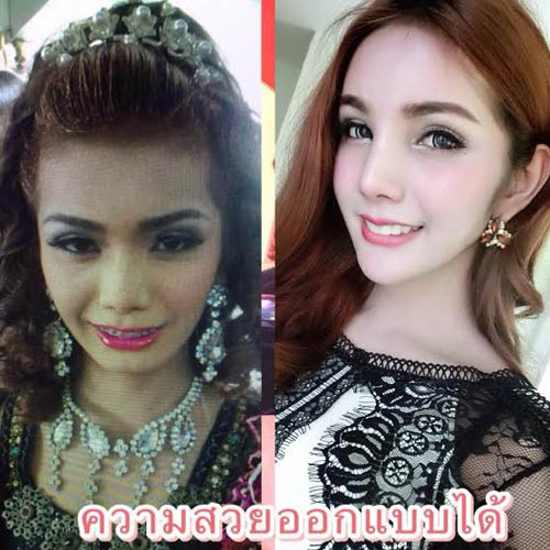 Yosita trước và sau thẩm mỹ