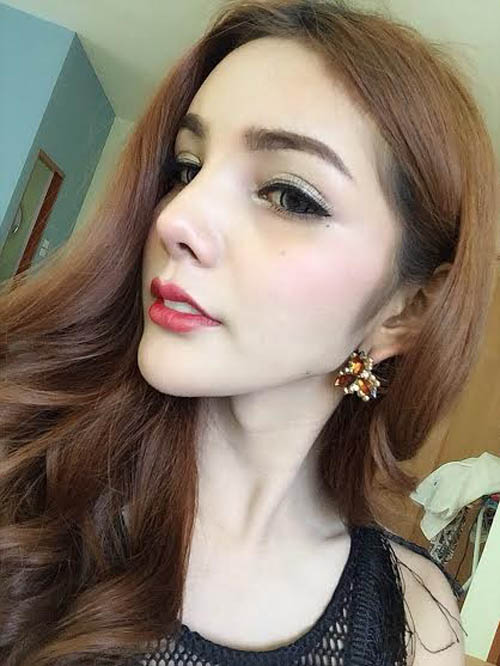 Sau khi phẫu thuật, Yosita đã có chiếc mũi tuyệt mỹ