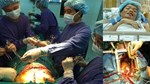 Các bác sĩ Mỹ hồi sinh” thành công trái tim người đã chết, mở ra đột phá mới trong việc cấy ghép nội tạng-3