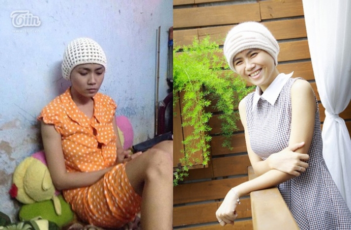 2 tháng sau khi biết tin bị bệnh, sức khỏe của cô suy giảm nghiêm trọng; mái tóc dài thướt tha cũng không còn.