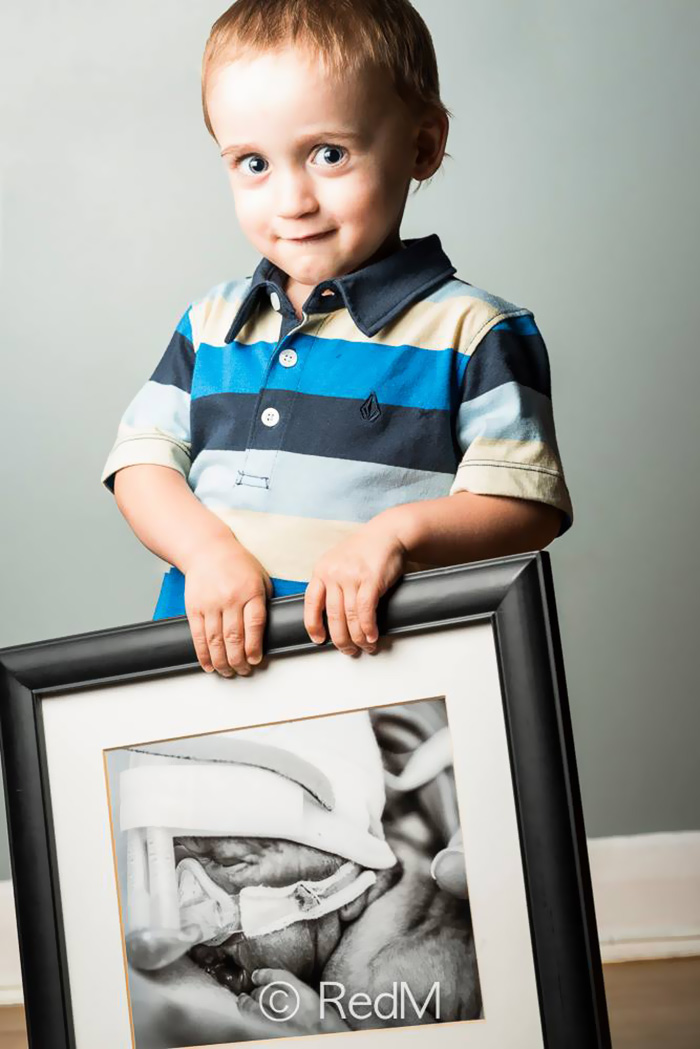 Cậu bé Zachary cất tiếng khóc chào đời vào tuần thứ 27 với các thiết bị y tế đầy mình. 