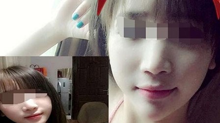 Thiếu nữ chết trong khách sạn: Dấu hiệu bất thường trên cơ thể