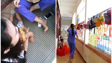 Vụ trói chân tay trẻ: ‘Bảo mẫu có thể bị xử phạt cao nhất 3 năm tù'