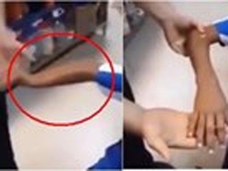 Clip hot: Choáng với cách nắn xương 