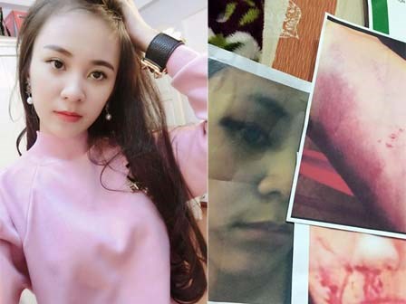 Những uẩn khúc trong vụ cô gái xinh đẹp tung ảnh tố chồng cũ bạo hành