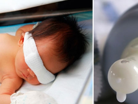 Cậu bé 11 tuổi mắt sưng như trứng, suýt mù vì bố mẹ cho nghịch điện thoại suốt 2 ngày-9