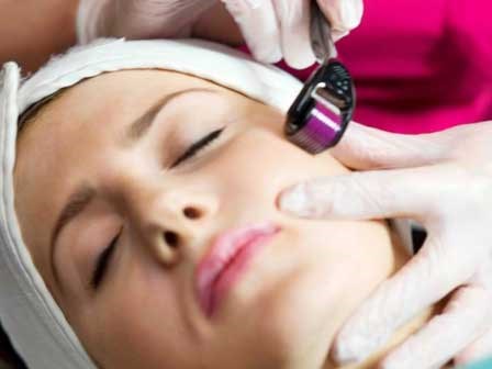Những điều cần biết khi làm đẹp da bằng phương pháp lăn kim