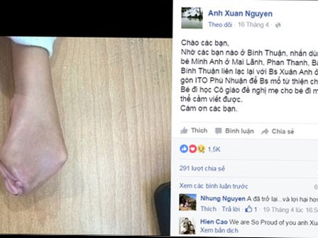 Cảm động bác sĩ đăng tìm bệnh nhi trên Facebook để chữa trị miễn phí