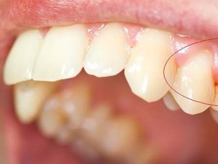 Hàm răng tiết lộ nhiều điều về sức khỏe của bạn