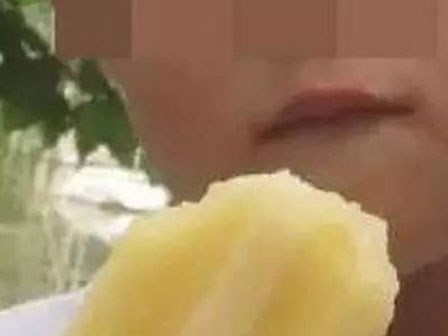 Cậu bé phải truyền máu gấp 5 lần lượng máu cơ thể chỉ vì 3 que kem