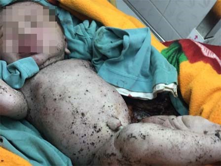 Phát hiện bé trai còn nguyên dây rốn trong hố rác