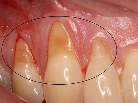 10 bài thuốc tại nhà có thể