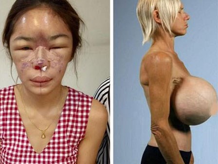 Bạn sẽ không đủ can đảm PTTM khi xem những hình ảnh này