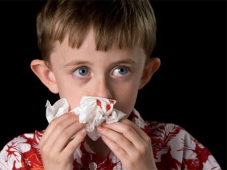 Con chảy máu mũi, bố mẹ bàng hoàng phát hiện hạt quế... mọc mầm trong mũi con