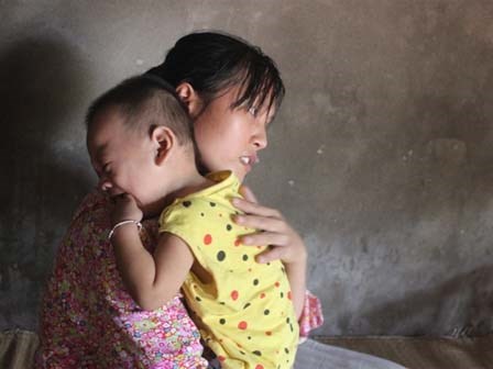 Mẹ đau đớn sinh hai con đều bị bại não