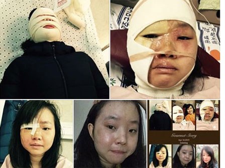 Câu chuyện của cô gái 2 lần trở về từ cõi chết khiến bao người xúc động