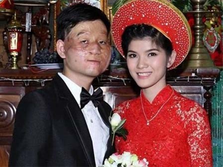 Sau hai năm kết hôn, cặp chồng xấu – vợ xinh nổi tiếng mạng giờ ra sao?
